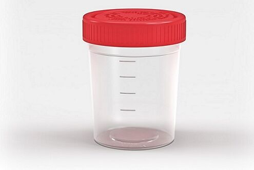 parasite testing container