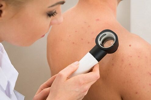 skin rash with parasites