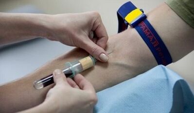 How to prepare for the parasitic test