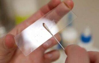 What tests should be performed for parasites