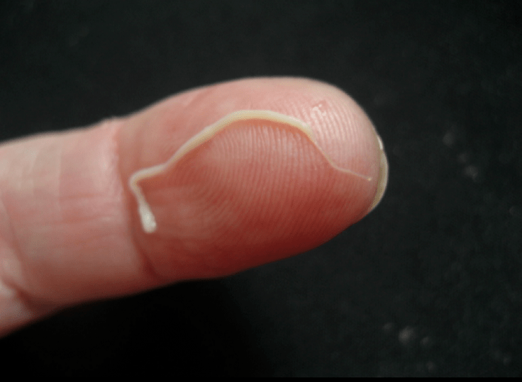 roundworm parasite of the human body